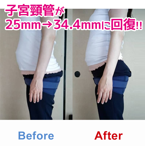 ビフォアーアフター