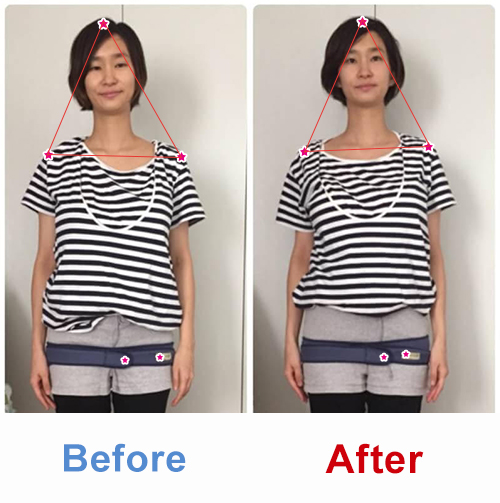 ビフォアーアフター