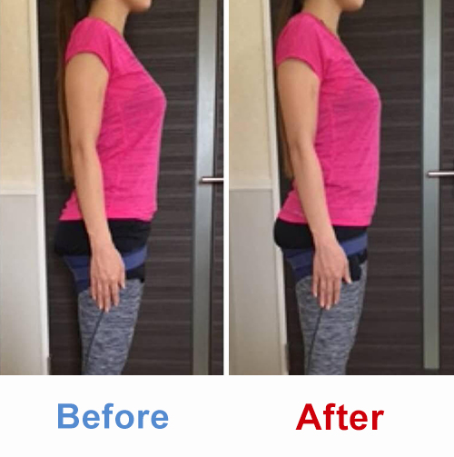 ビフォアーアフター