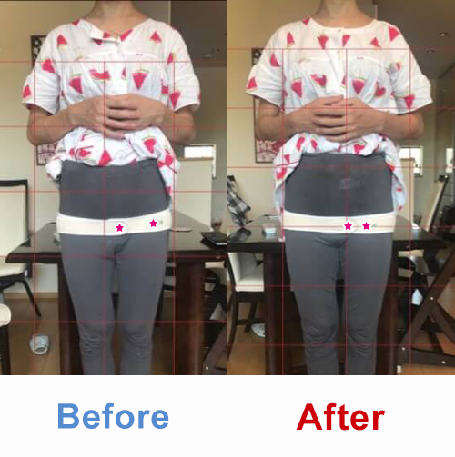 ビフォアーアフター