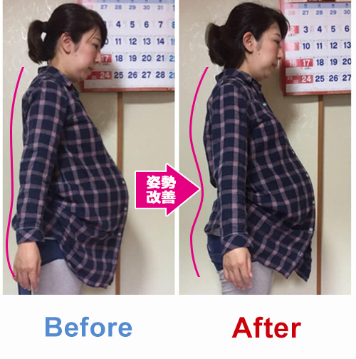 ビフォアーアフター