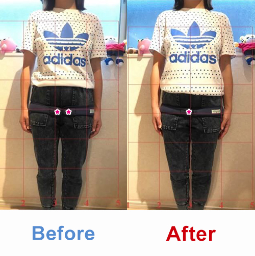 ビフォアーアフター