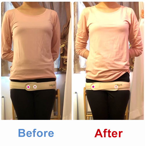 ビフォアーアフター