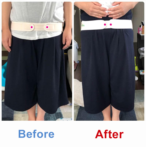 ビフォアーアフター