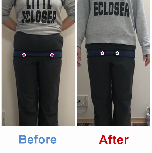 ビフォアーアフター