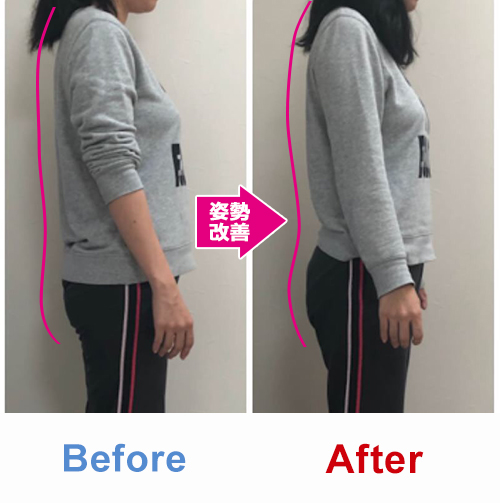 ビフォアーアフター