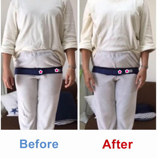 ビフォアーアフター