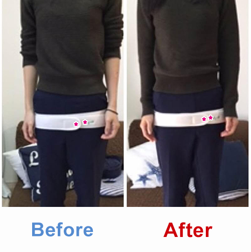 ビフォアーアフター