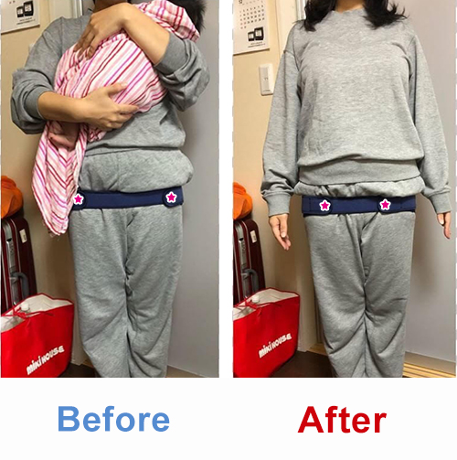 ビフォアーアフター