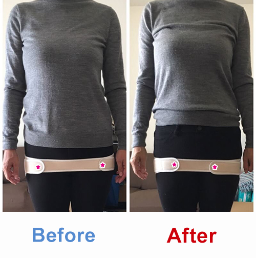 ビフォアーアフター