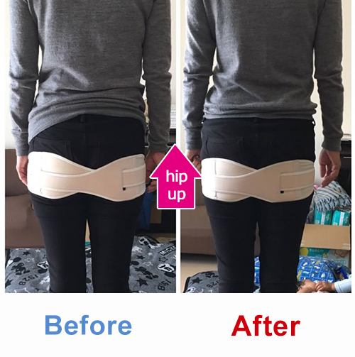 ビフォアーアフター