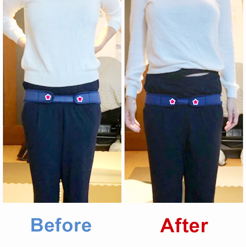 ビフォアーアフター