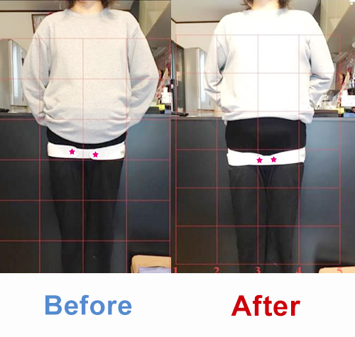 ビフォアーアフター