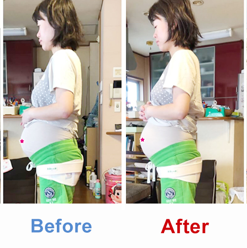 ビフォアーアフター