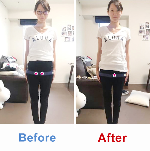 ビフォアーアフター