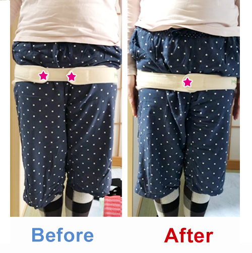 ビフォアーアフター