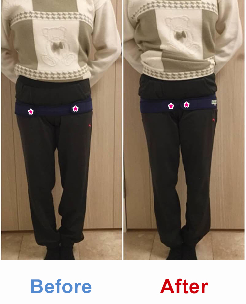 ビフォアーアフター