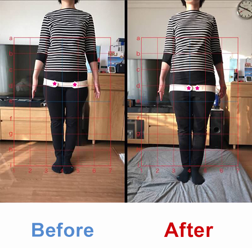 ビフォアーアフター