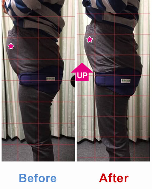 ビフォアーアフター