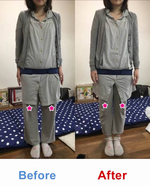 ビフォアーアフター