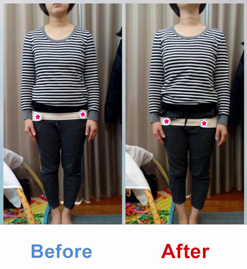 ビフォアーアフター