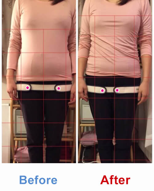 ビフォアーアフター