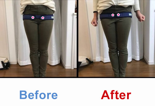 ビフォアーアフター