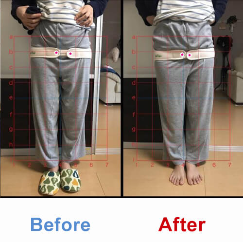 ビフォアーアフター