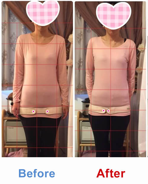 ビフォアーアフター