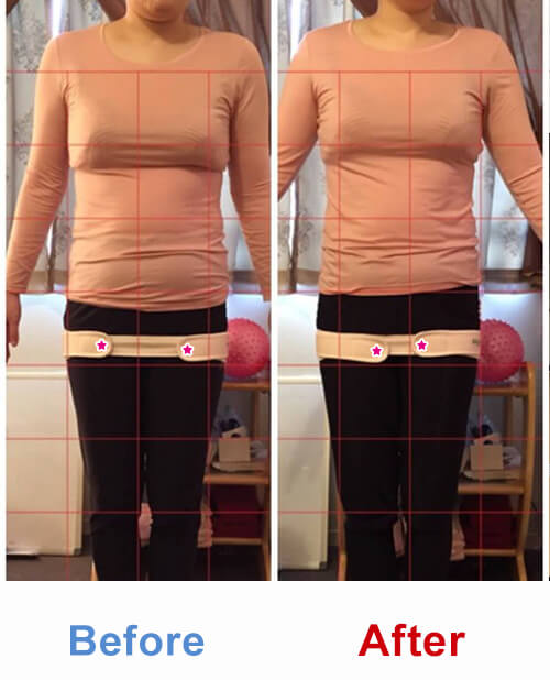 ビフォアーアフター