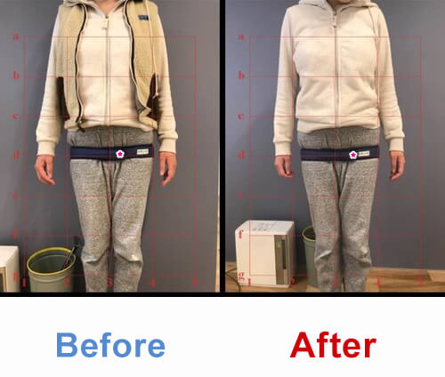 ビフォアーアフター