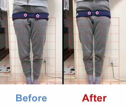 ビフォアーアフター