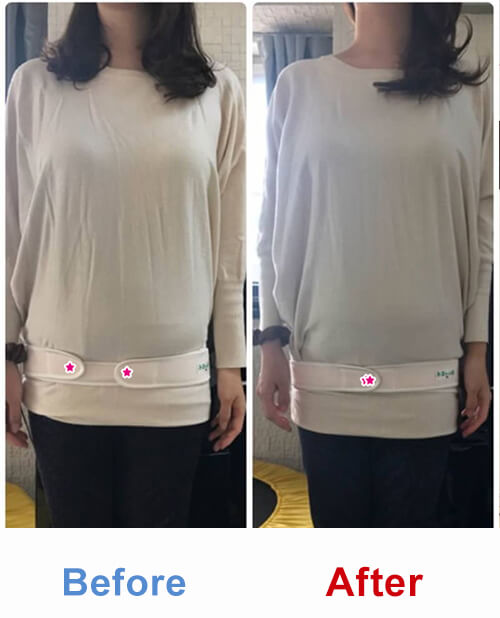 ビフォアーアフター