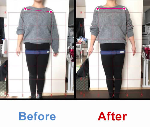 ビフォアーアフター