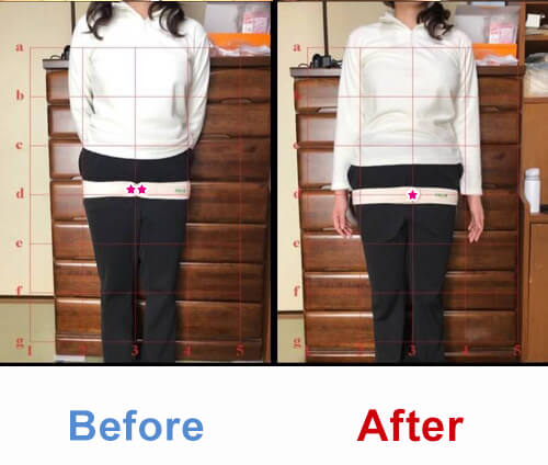 ビフォアーアフター