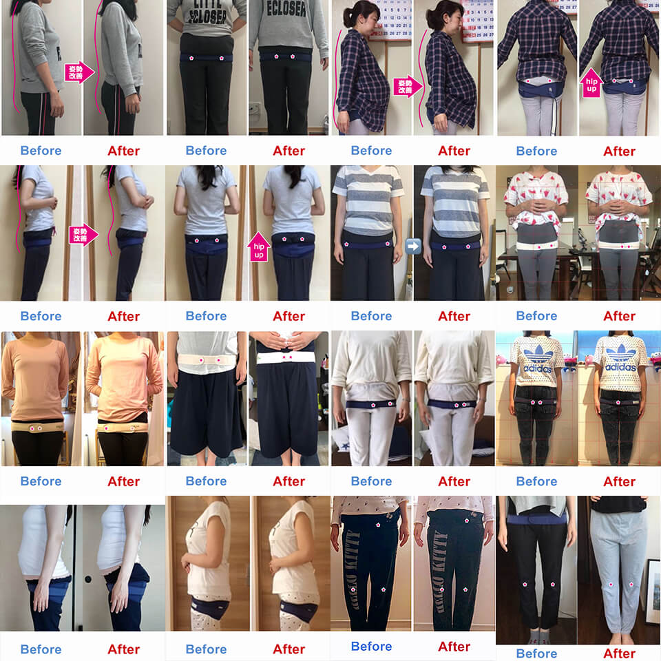 ビフォアーアフターのお客様写真