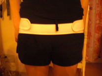 産後 骨盤 矯正 整体 トコちゃんベルト 前 写真