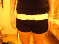 産後 骨盤 矯正 整体 トコちゃんベルト 後 写真