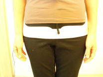 産後 骨盤 矯正 整体 トコちゃんベルト 前 写真