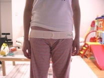 産後 骨盤 矯正 整体 トコちゃんベルト 後 写真