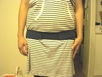 産後 骨盤 矯正 整体 トコちゃんベルト 前 写真