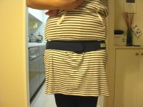 産後 骨盤 矯正 整体 トコちゃんベルト 後 写真