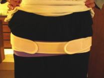 産後 骨盤 矯正 整体 トコちゃんベルト 前 写真