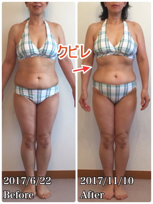 骨盤臓器脱がベルト装着で完全に治り、スタイルも良くなった!後ろ姿