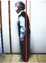 猫背 姿勢 整体前 写真