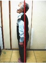 猫背 姿勢 整体後 写真