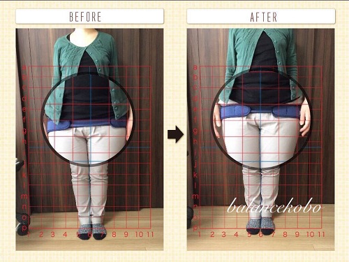 東京都 江戸川区 一之江で産後骨盤矯正before after