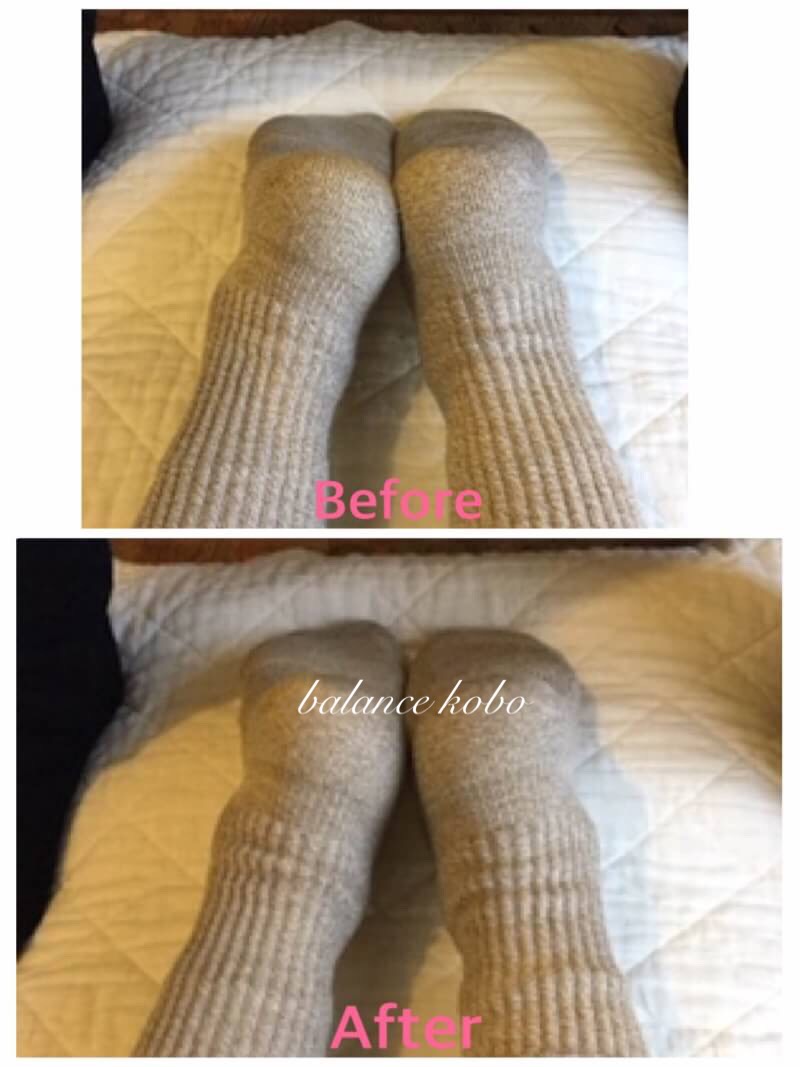 ビフォアーアフター