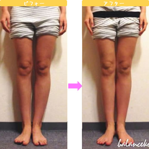 美脚リフレ