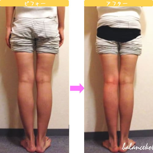 美脚リフレ